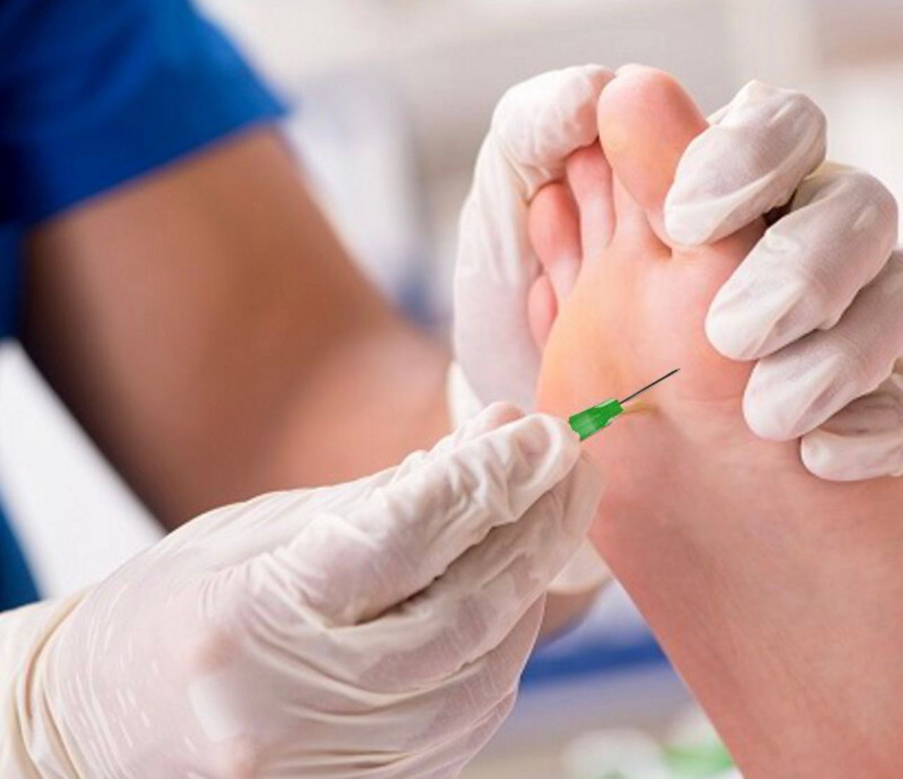 Promenade Foot Clinic, Cheltenham - Vitamin Injections Promenade Foot Clinic, Cheltenham - Vitamin Injections